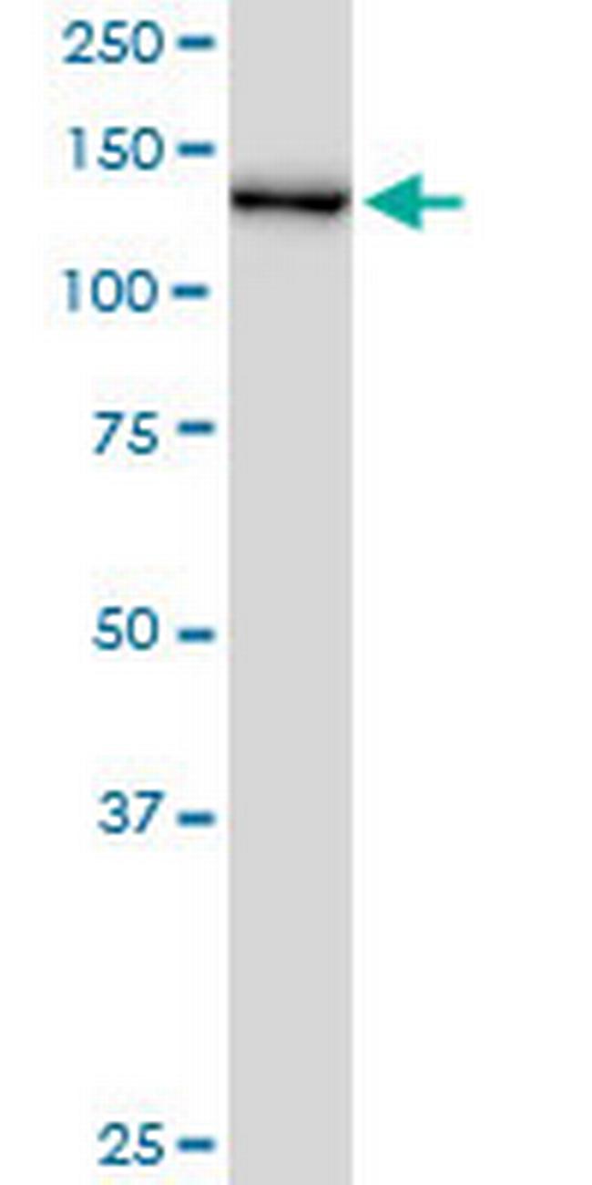 CHERP Antibody in Western Blot (WB)