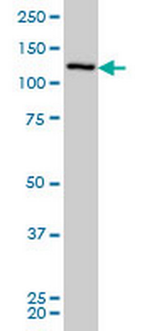 CHERP Antibody in Western Blot (WB)