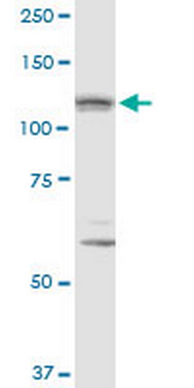IPO8 Antibody in Western Blot (WB)