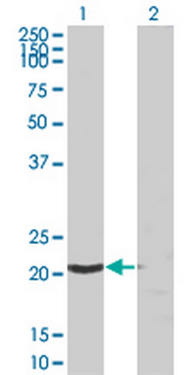 SSSCA1 Antibody in Western Blot (WB)
