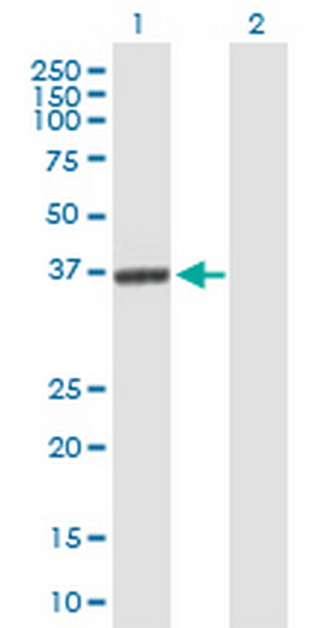 GLRX3 Antibody in Western Blot (WB)