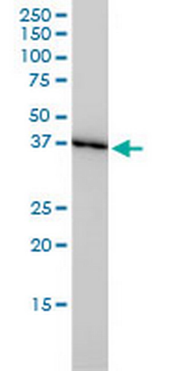 GLRX3 Antibody in Western Blot (WB)