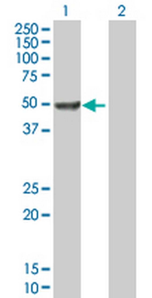 DCTN2 Antibody in Western Blot (WB)