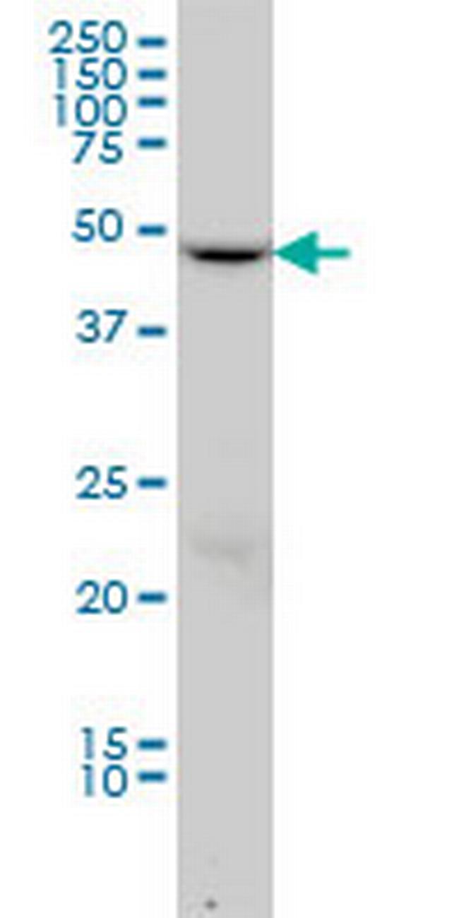 DCTN2 Antibody in Western Blot (WB)