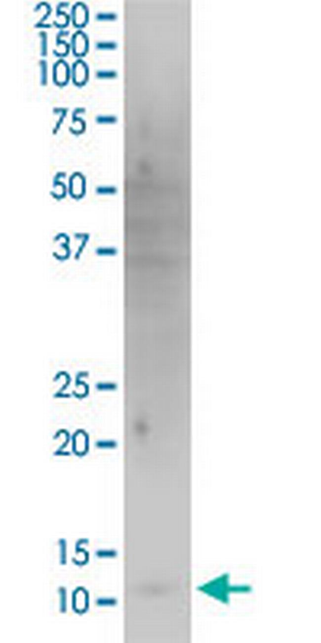 HBXIP Antibody in Western Blot (WB)