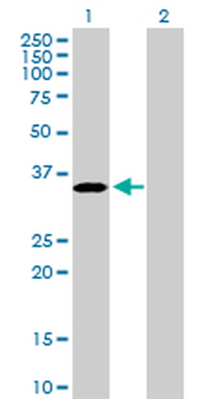PROCR Antibody in Western Blot (WB)