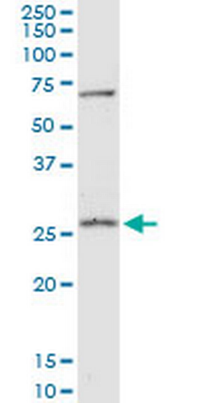 PRDX4 Antibody in Western Blot (WB)