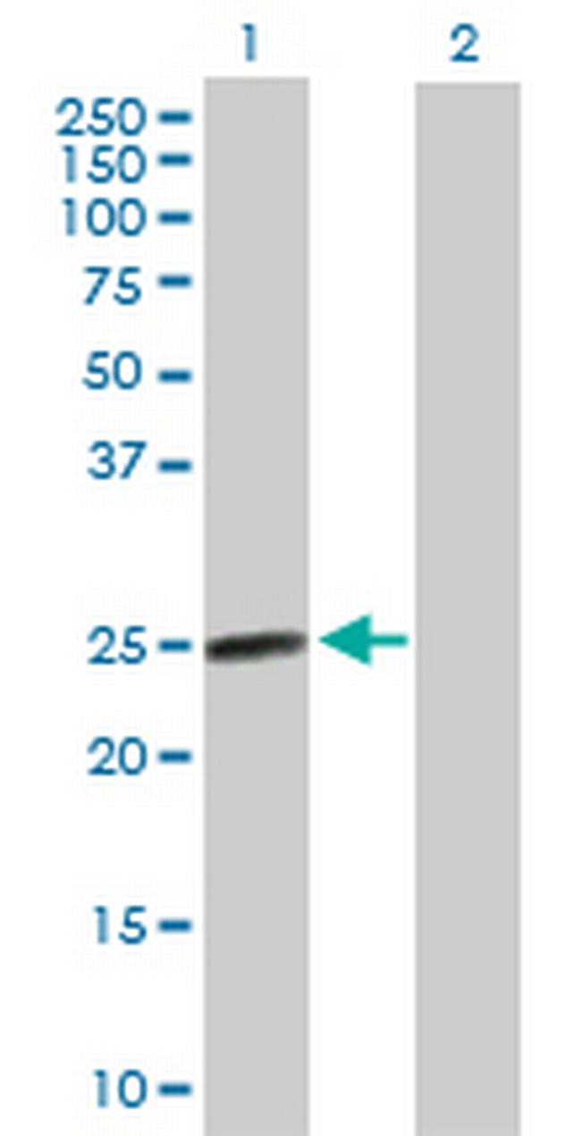 AGPAT2 Antibody in Western Blot (WB)
