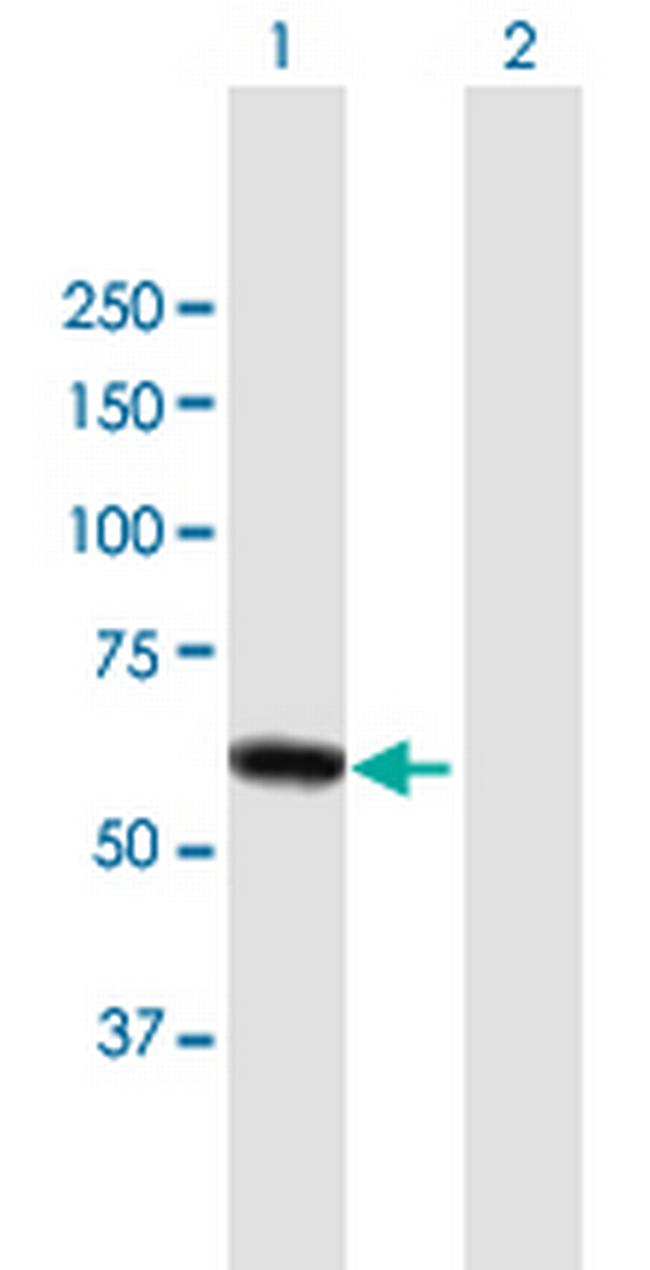 DPYSL4 Antibody in Western Blot (WB)