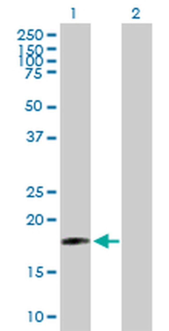 SIVA Antibody in Western Blot (WB)