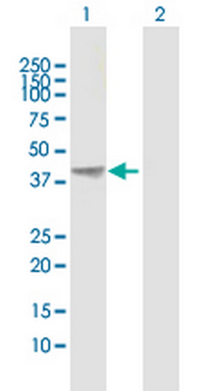 AHSA1 Antibody in Western Blot (WB)