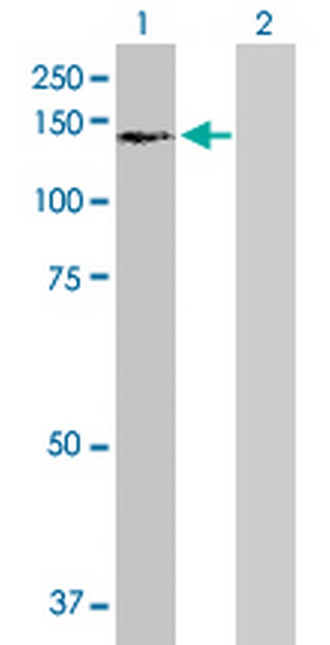 USP16 Antibody in Western Blot (WB)