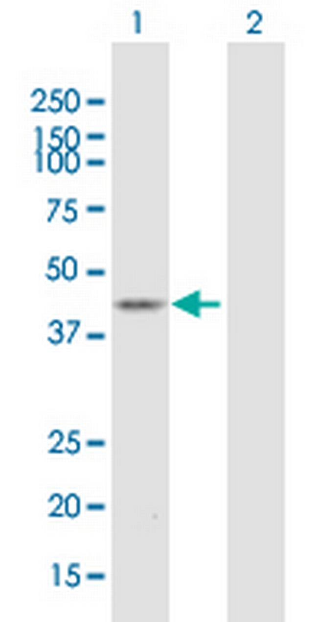 ST6GALNAC2 Antibody in Western Blot (WB)