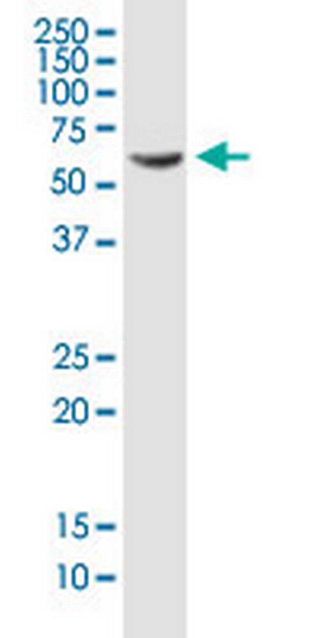 PDLIM5 Antibody in Western Blot (WB)