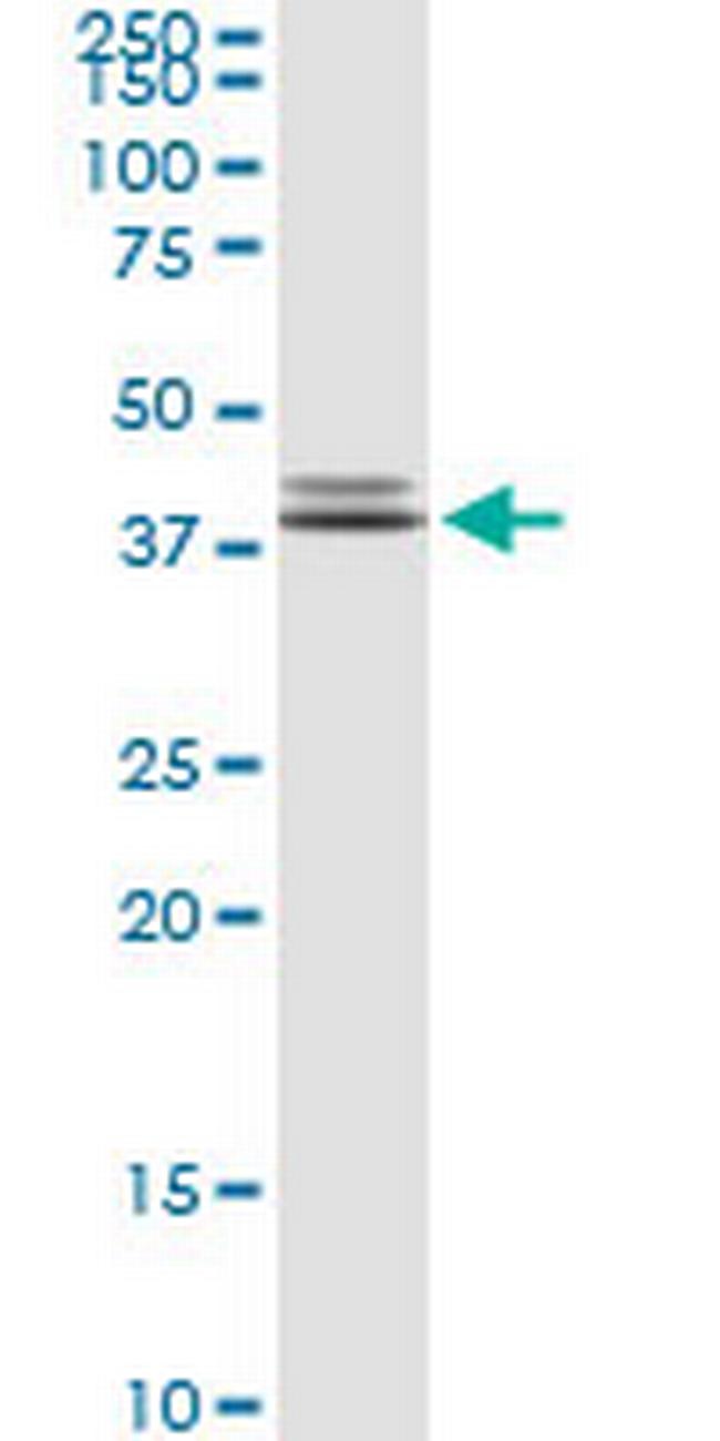 POLR3F Antibody in Western Blot (WB)