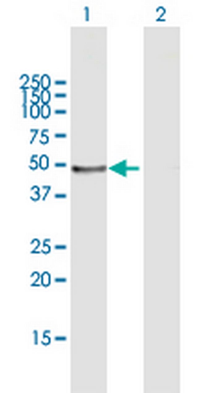 LEFTY1 Antibody in Western Blot (WB)