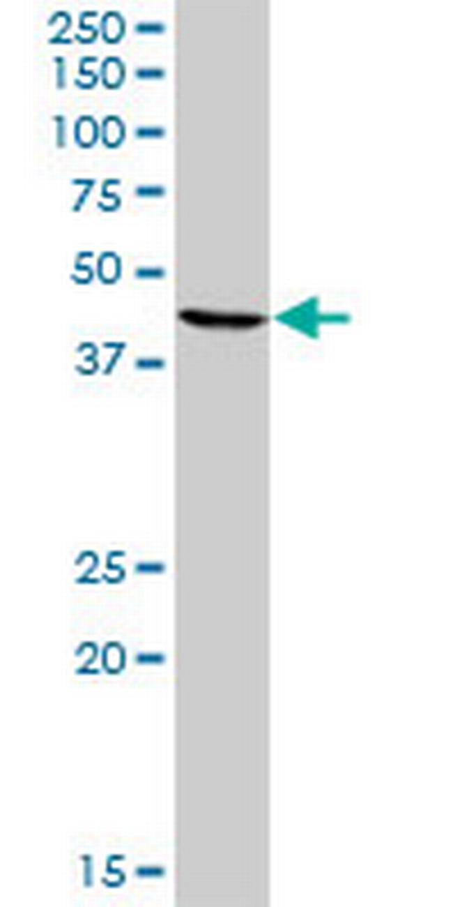 TUSC4 Antibody in Western Blot (WB)