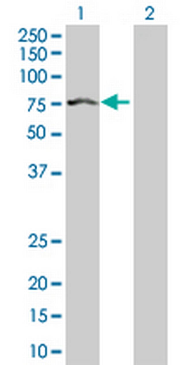 IGF2BP2 Antibody in Western Blot (WB)
