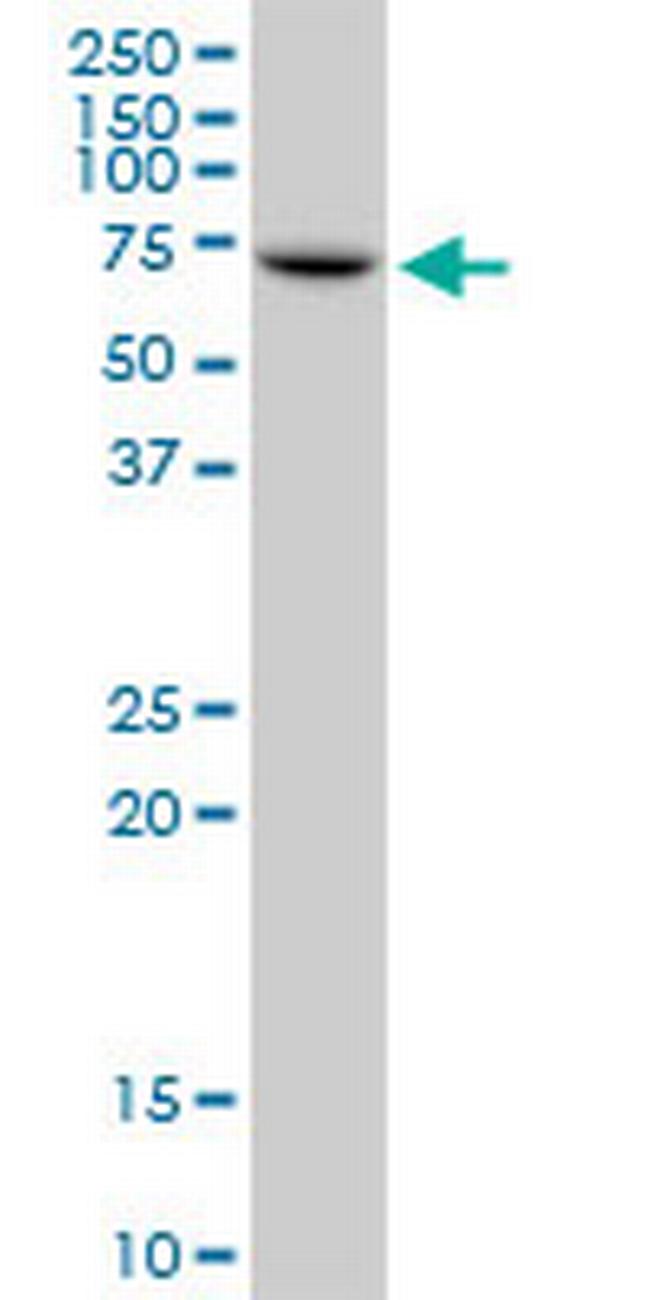 IGF2BP2 Antibody in Western Blot (WB)