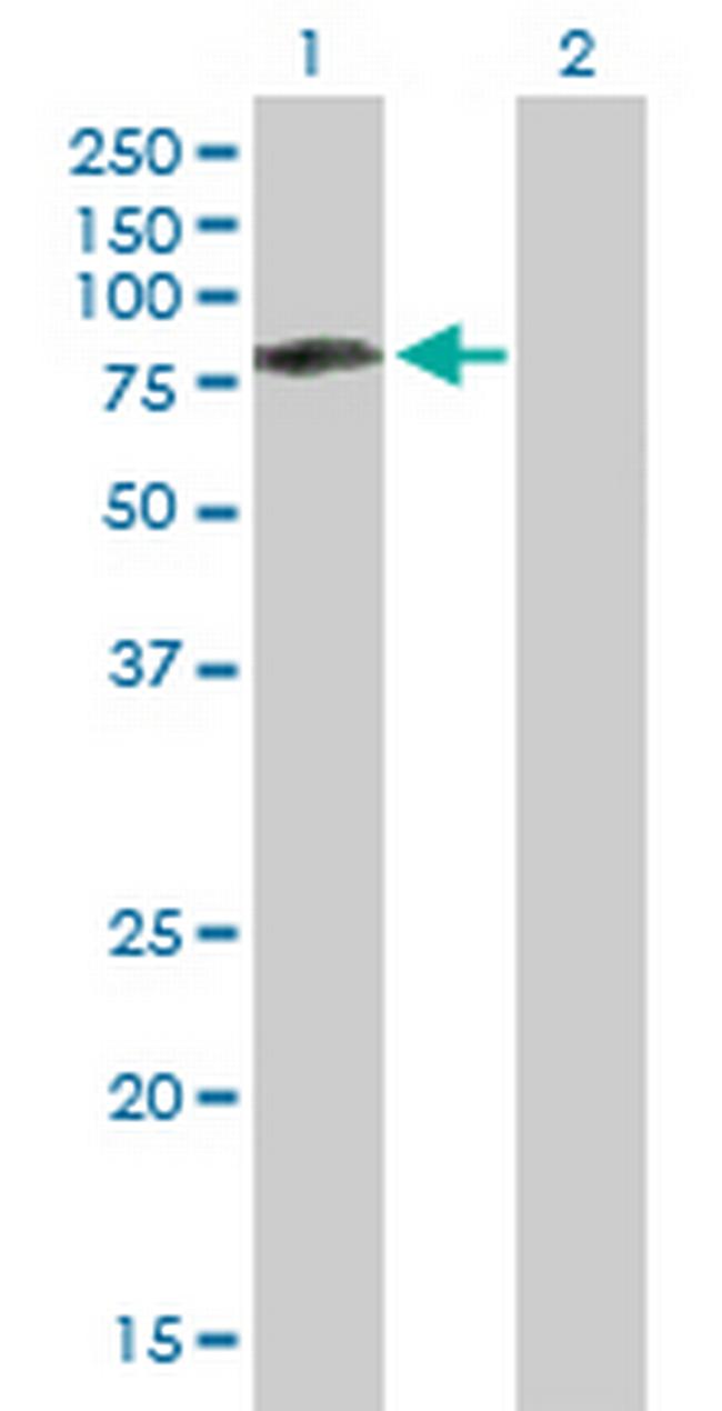 CAMKK2 Antibody in Western Blot (WB)