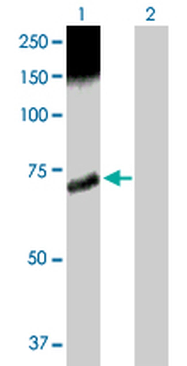 CAMKK2 Antibody in Western Blot (WB)