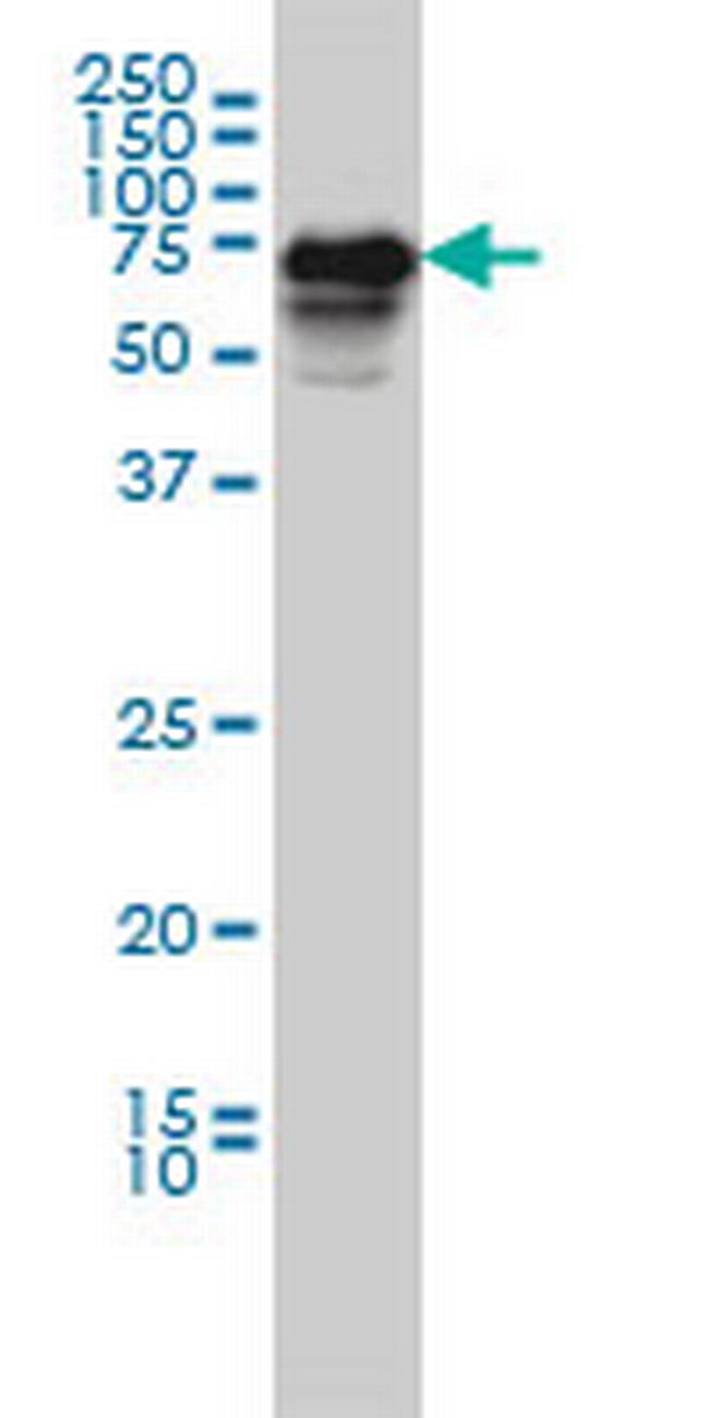 CAMKK2 Antibody in Western Blot (WB)