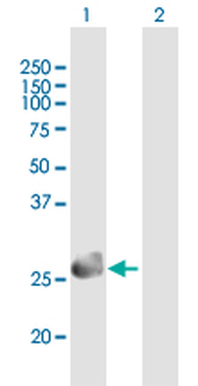 SPINT2 Antibody in Western Blot (WB)
