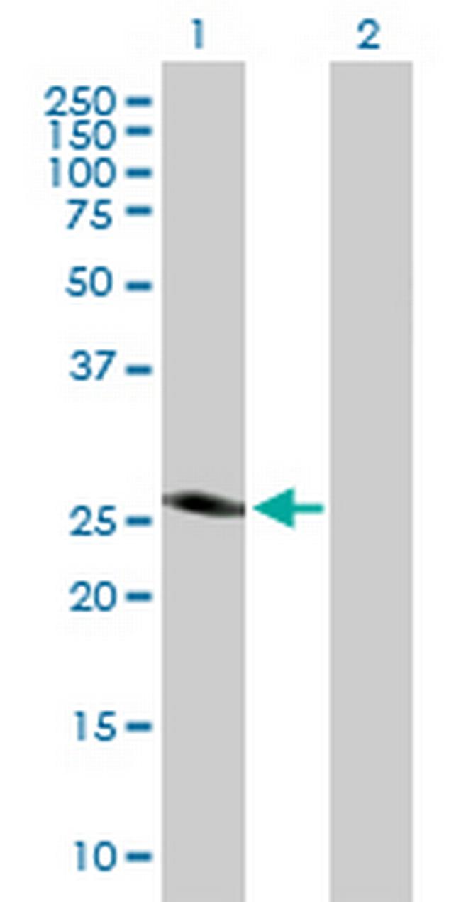 SPINT2 Antibody in Western Blot (WB)