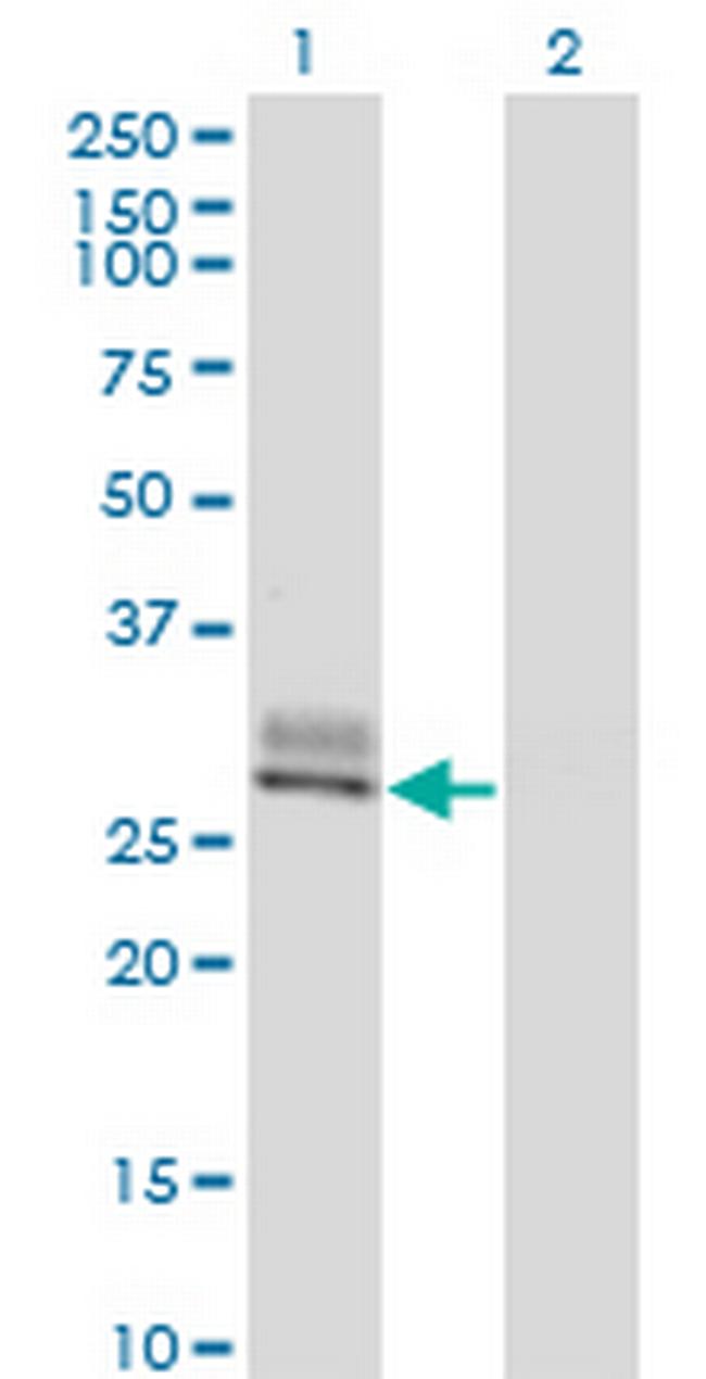 SPINT2 Antibody in Western Blot (WB)