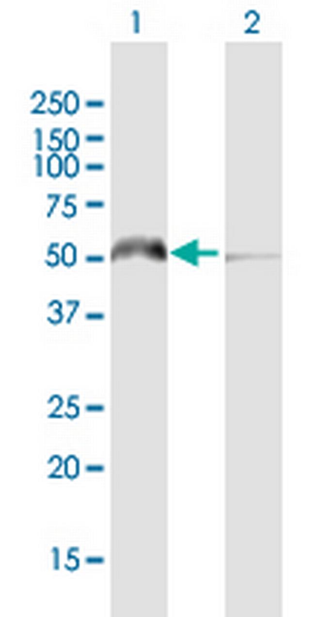 KHDRBS3 Antibody in Western Blot (WB)