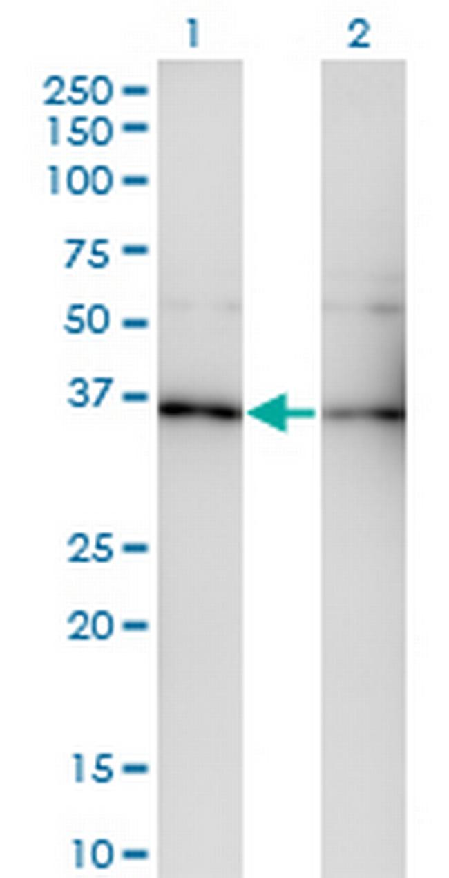 GNB5 Antibody in Western Blot (WB)
