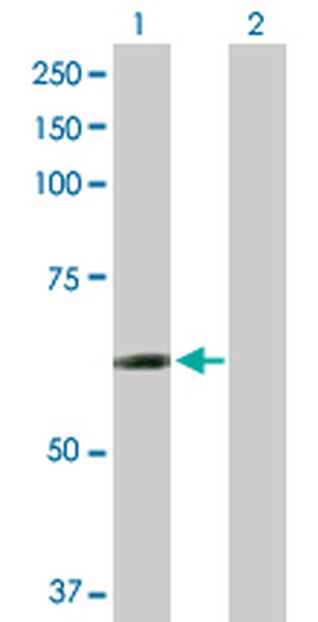 CCT6B Antibody in Western Blot (WB)