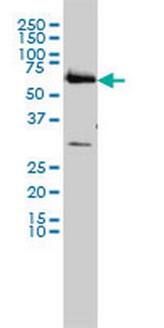 CCT6B Antibody in Western Blot (WB)