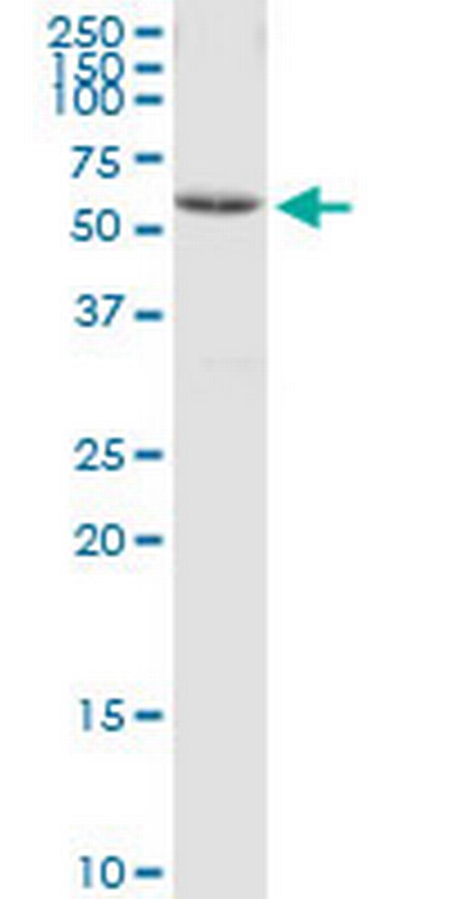 CCT8 Antibody in Western Blot (WB)