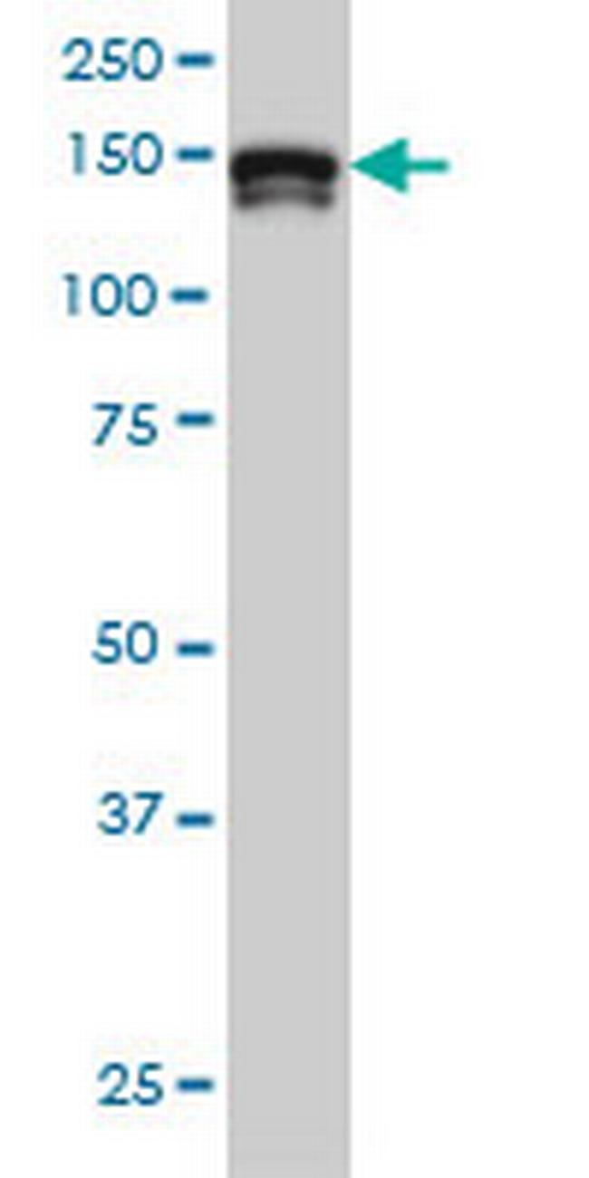STAG2 Antibody in Western Blot (WB)