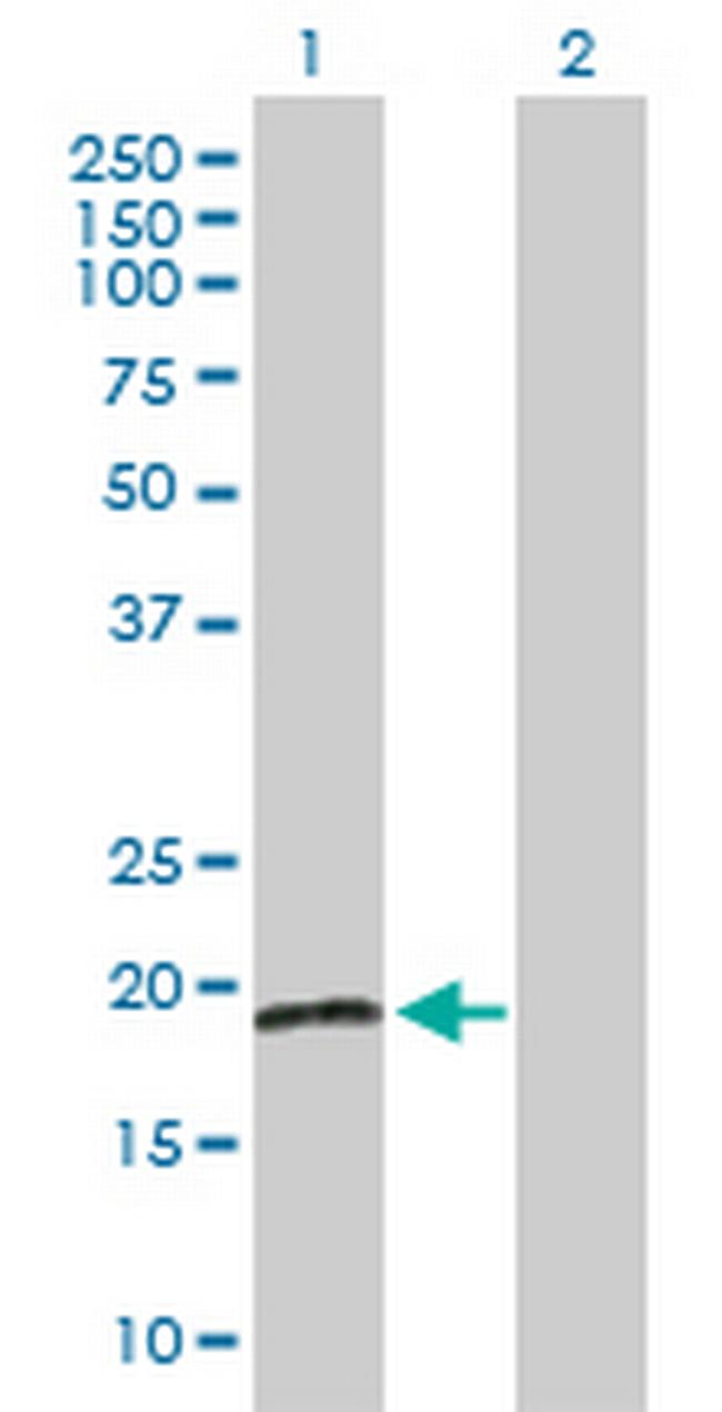 RBBP9 Antibody in Western Blot (WB)
