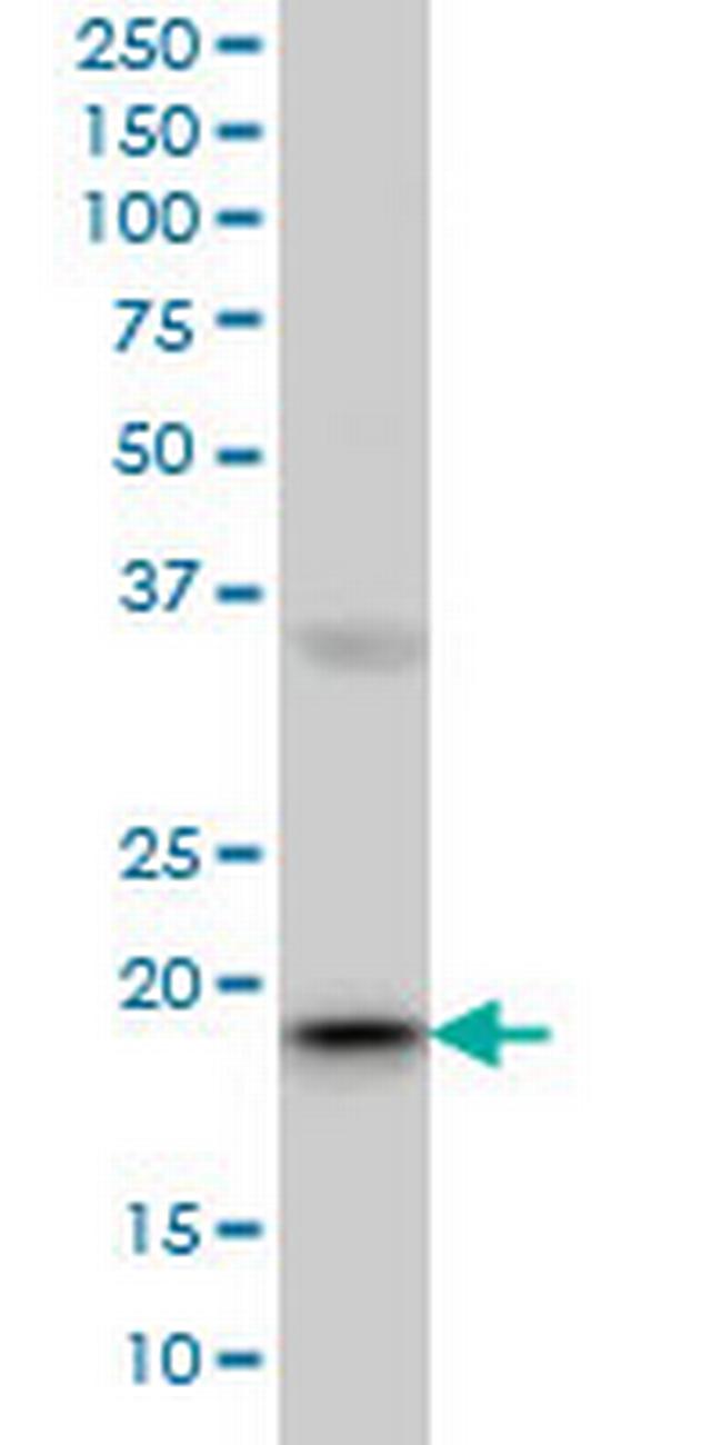 RBBP9 Antibody in Western Blot (WB)