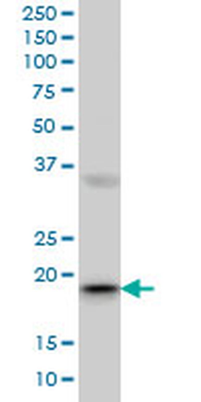 RBBP9 Antibody in Western Blot (WB)