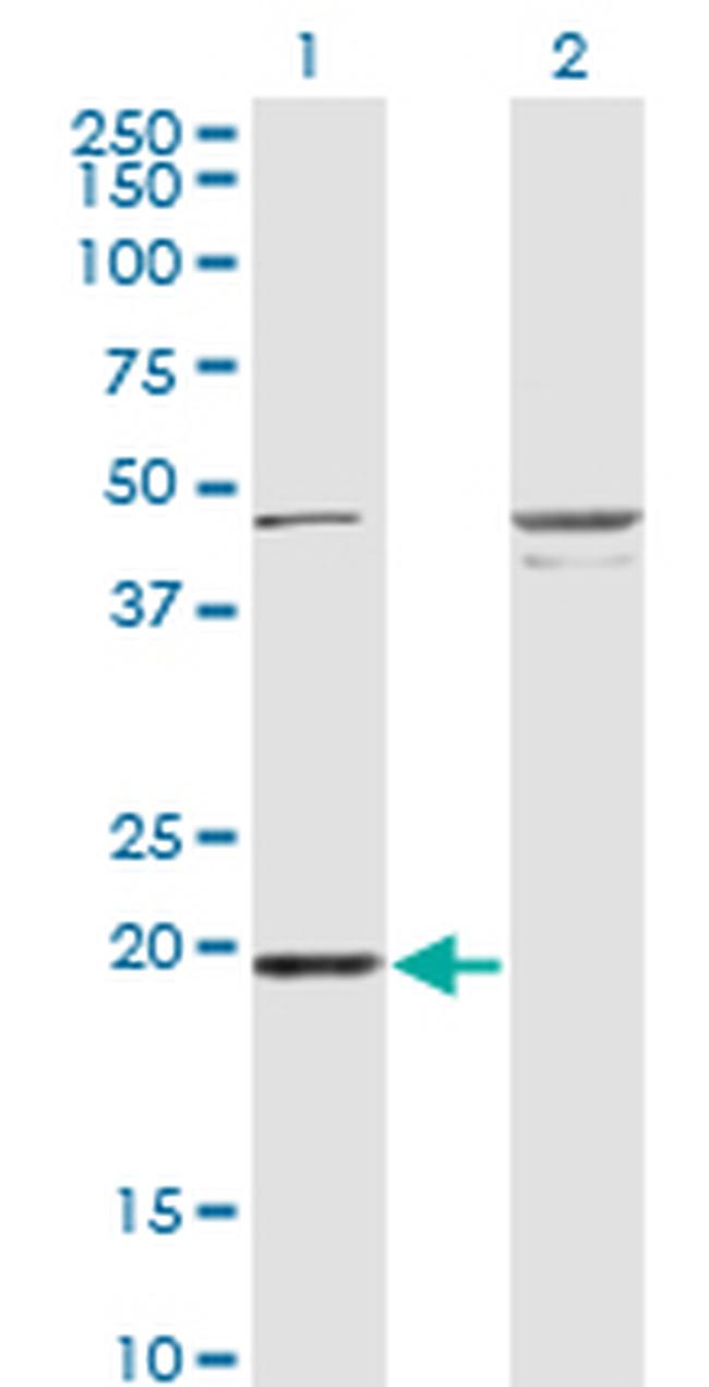 RBBP9 Antibody in Western Blot (WB)