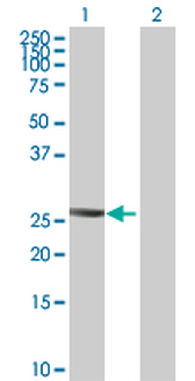 PTTG2 Antibody in Western Blot (WB)