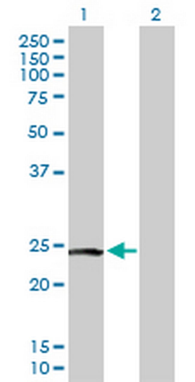PTTG2 Antibody in Western Blot (WB)