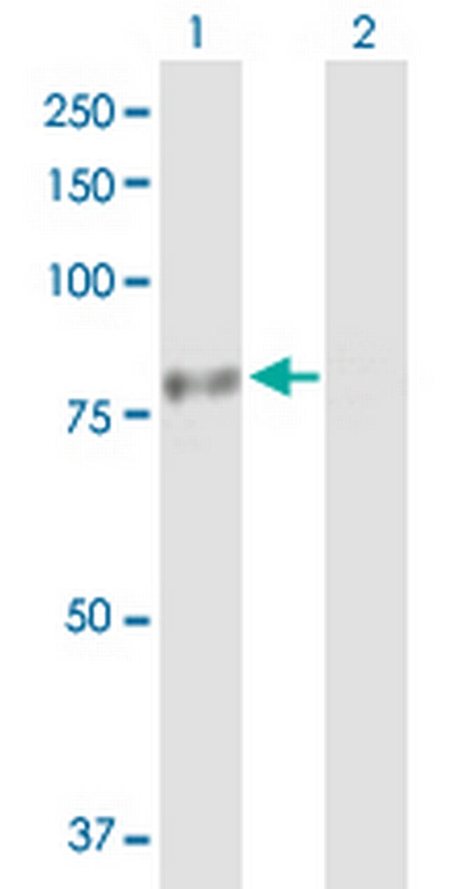 PHTF1 Antibody in Western Blot (WB)