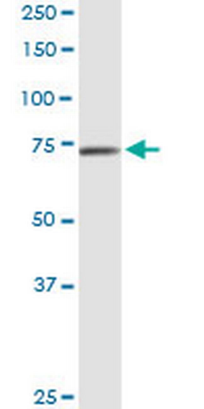 CAPN9 Antibody in Western Blot (WB)