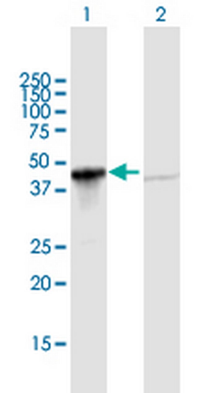 GIPC1 Antibody in Western Blot (WB)