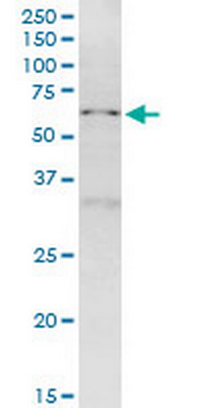 NUP50 Antibody in Western Blot (WB)