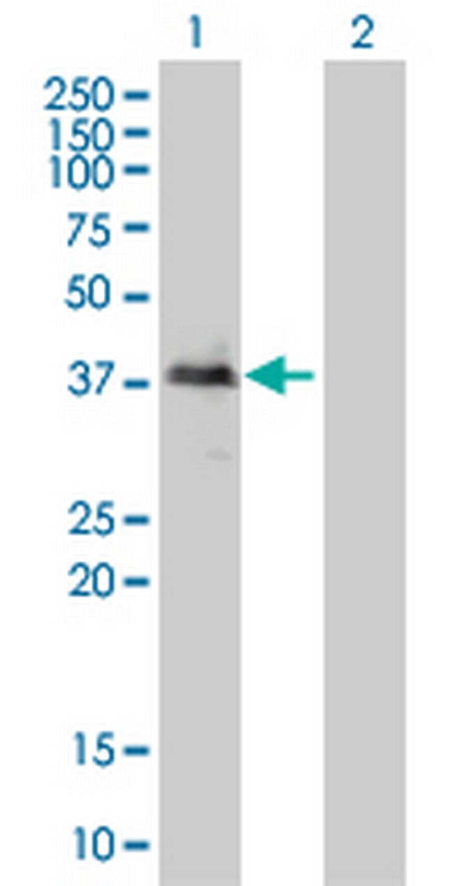 TOB2 Antibody in Western Blot (WB)