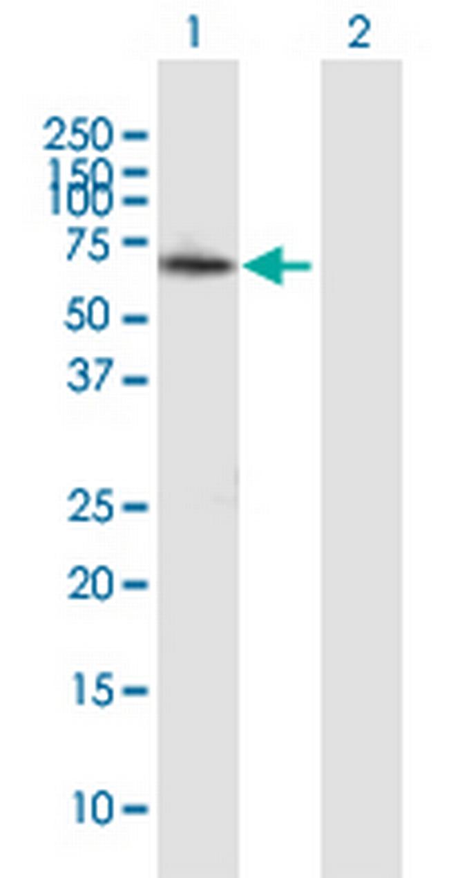 ZMYND11 Antibody in Western Blot (WB)