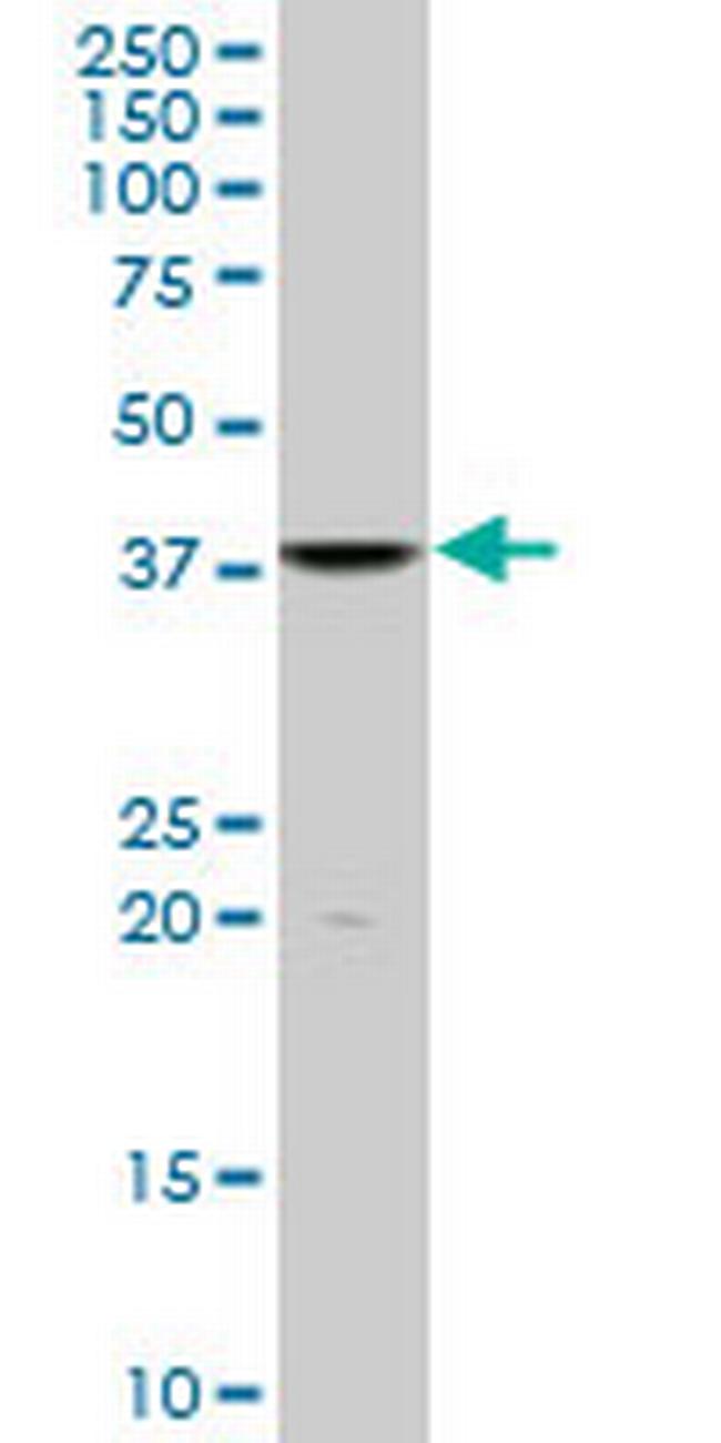 FUSIP1 Antibody in Western Blot (WB)