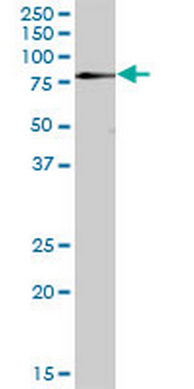 ZNF266 Antibody in Western Blot (WB)