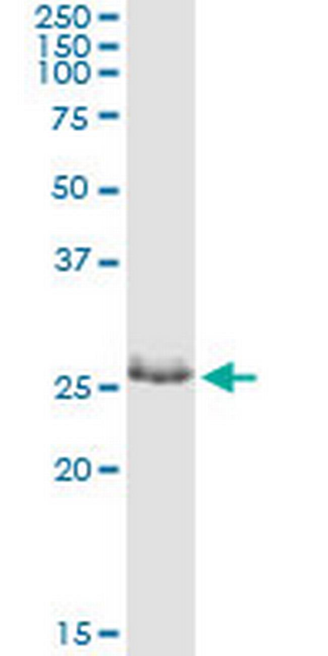 ZNF266 Antibody in Immunoprecipitation (IP)